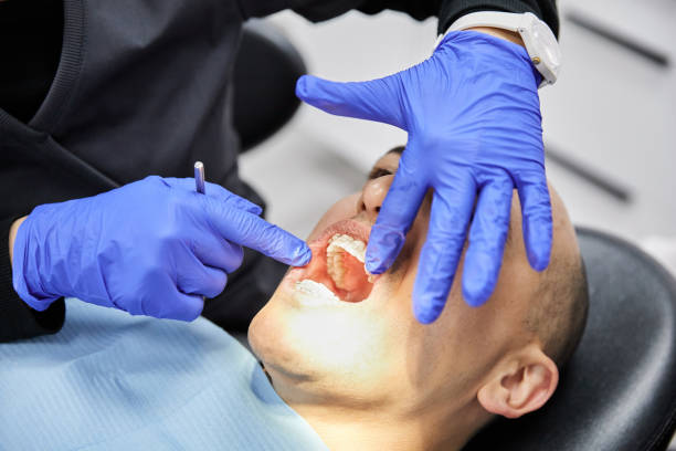 Best Emergency Root Canal Treatment in Wellington, KS